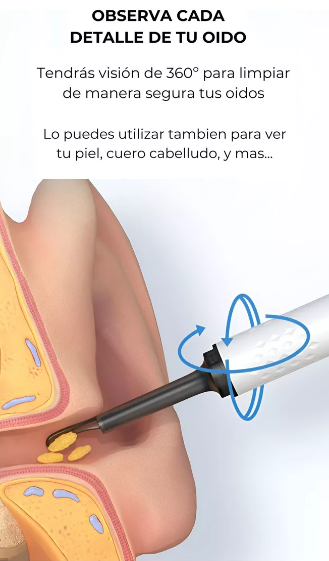 LIMPIADOR DE OIDOS CON CAMARA RECARGABLE